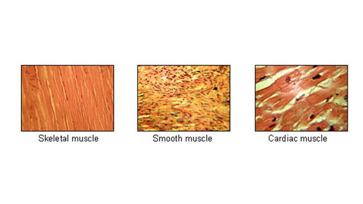 Berikut ini yang bukan ciri-ciri otot polos adalah